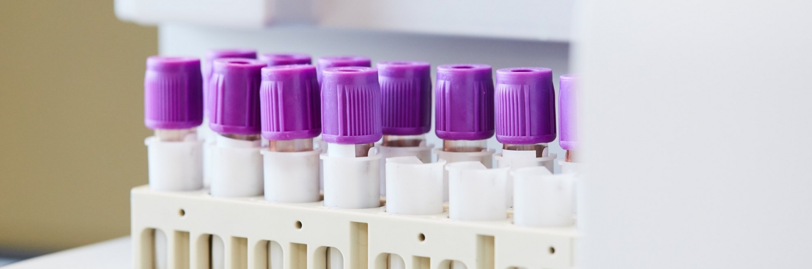 Prise De Sang Enfants 0 15 Ans Test Pcr Covid 19 Enfants De Moins De 2 Ans Kannerklinik Prise De Sang Enfants 0 15 Ans Test Pcr Covid 19 Enfants De Moins De 2 Ans Kannerklinik
