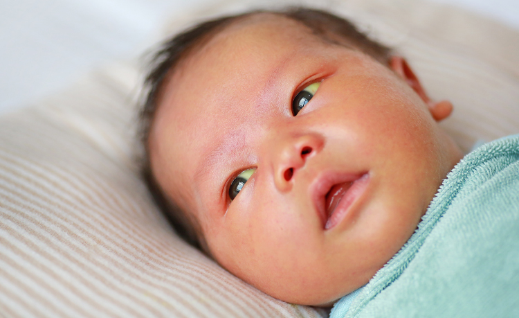 Bébé avec le blanc des yeux jaunes