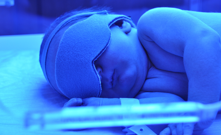 Bébé dormant sous une lampe bleue avec un bandeau sur les yeux