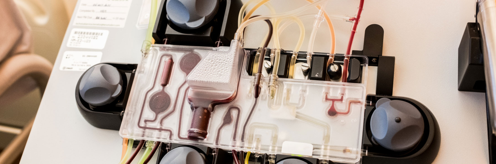 Un nouveau traitement CAR-T Cells désormais disponible au CHL pour le myélome multiple en rechute et réfractaire