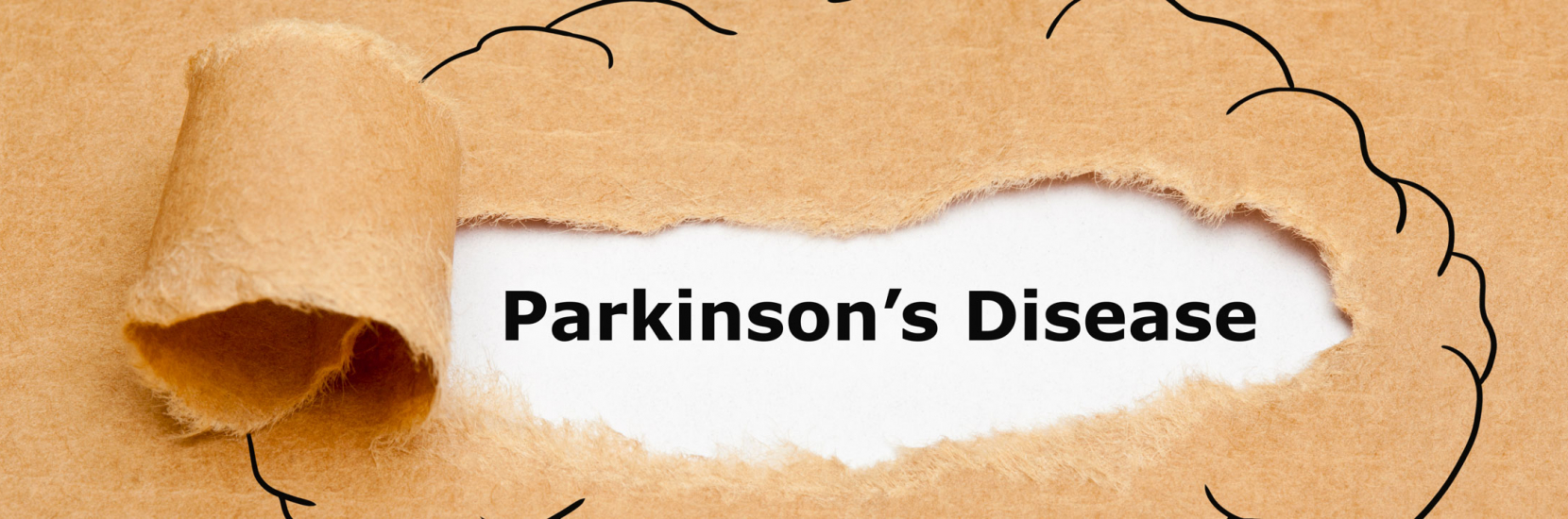 Faire progresser le traitement de la maladie de Parkinson